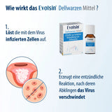 Dellwarzen Mittel