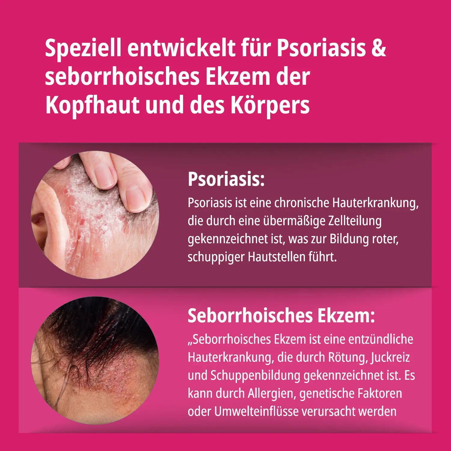 Psoriasis & Ekzem Shampoo Doppelpack