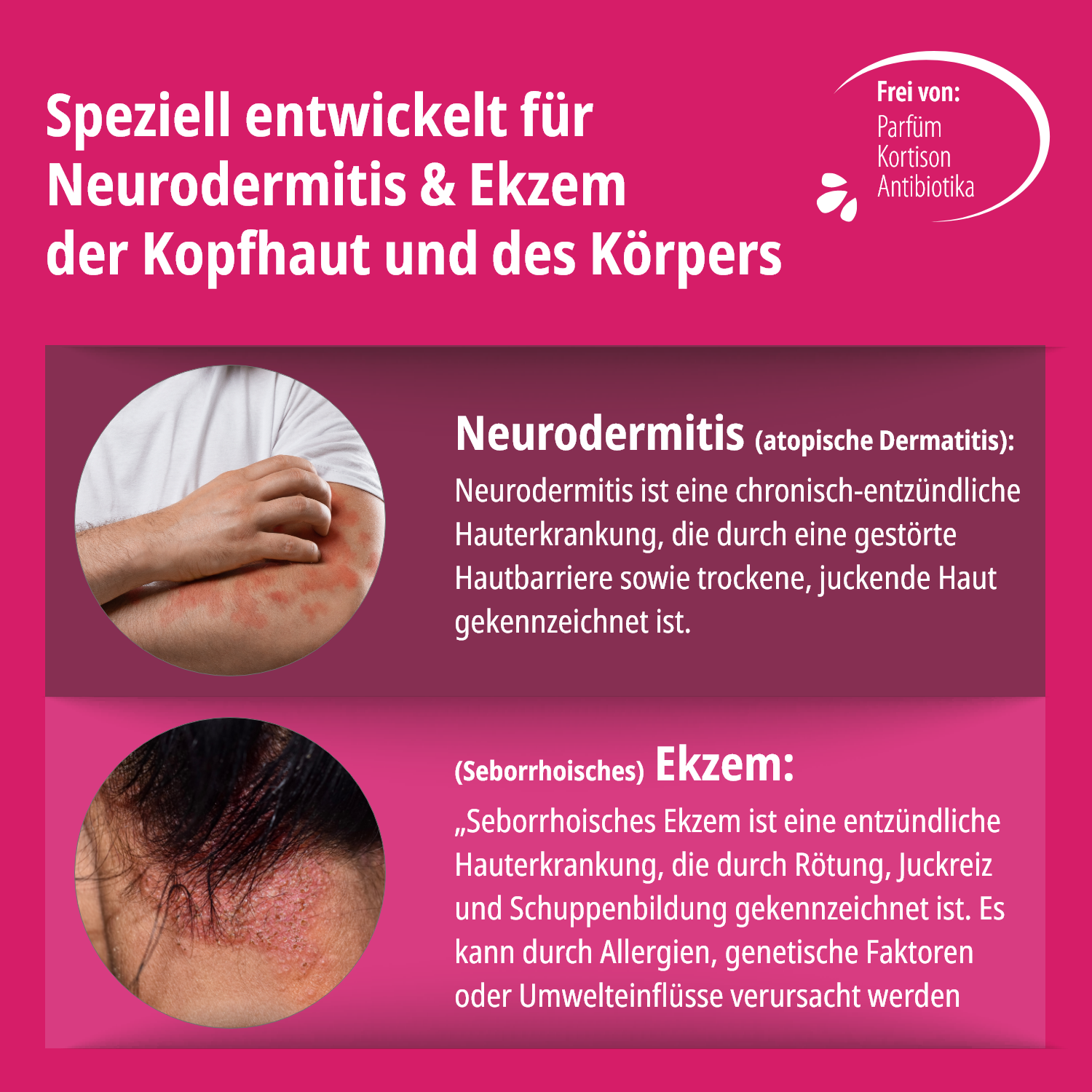 Ekzem & Neurodermitis Intensiv Bundle (Creme + Lotion + Shampoo)