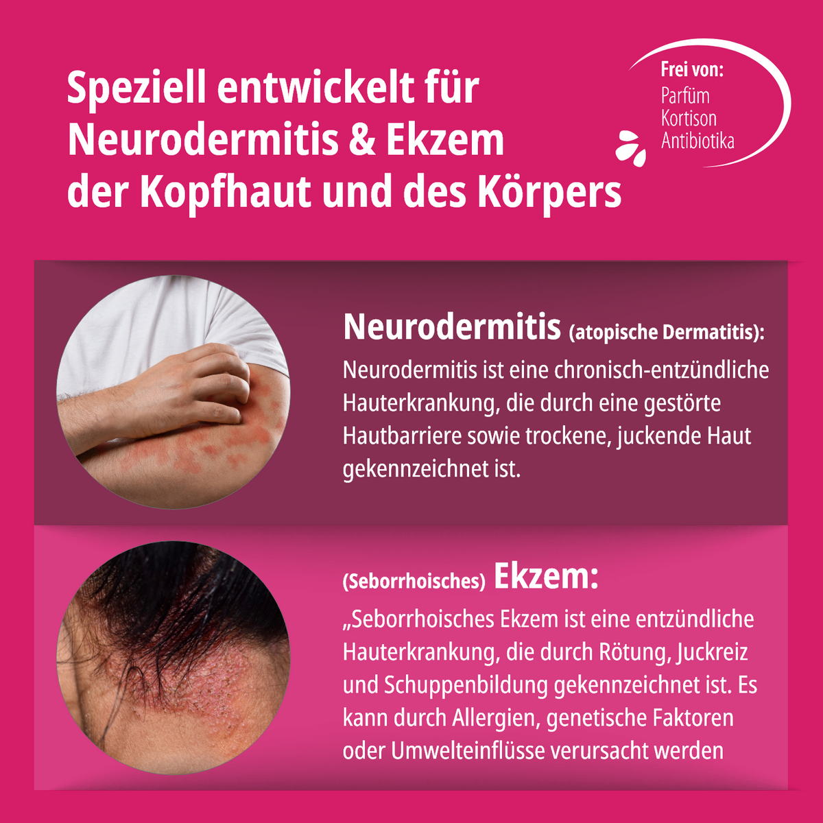 Ekzem & Neurodermitis Creme Doppelpack