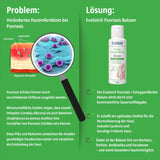 Psoriasis Schuppenflechte Balsam, 100ml