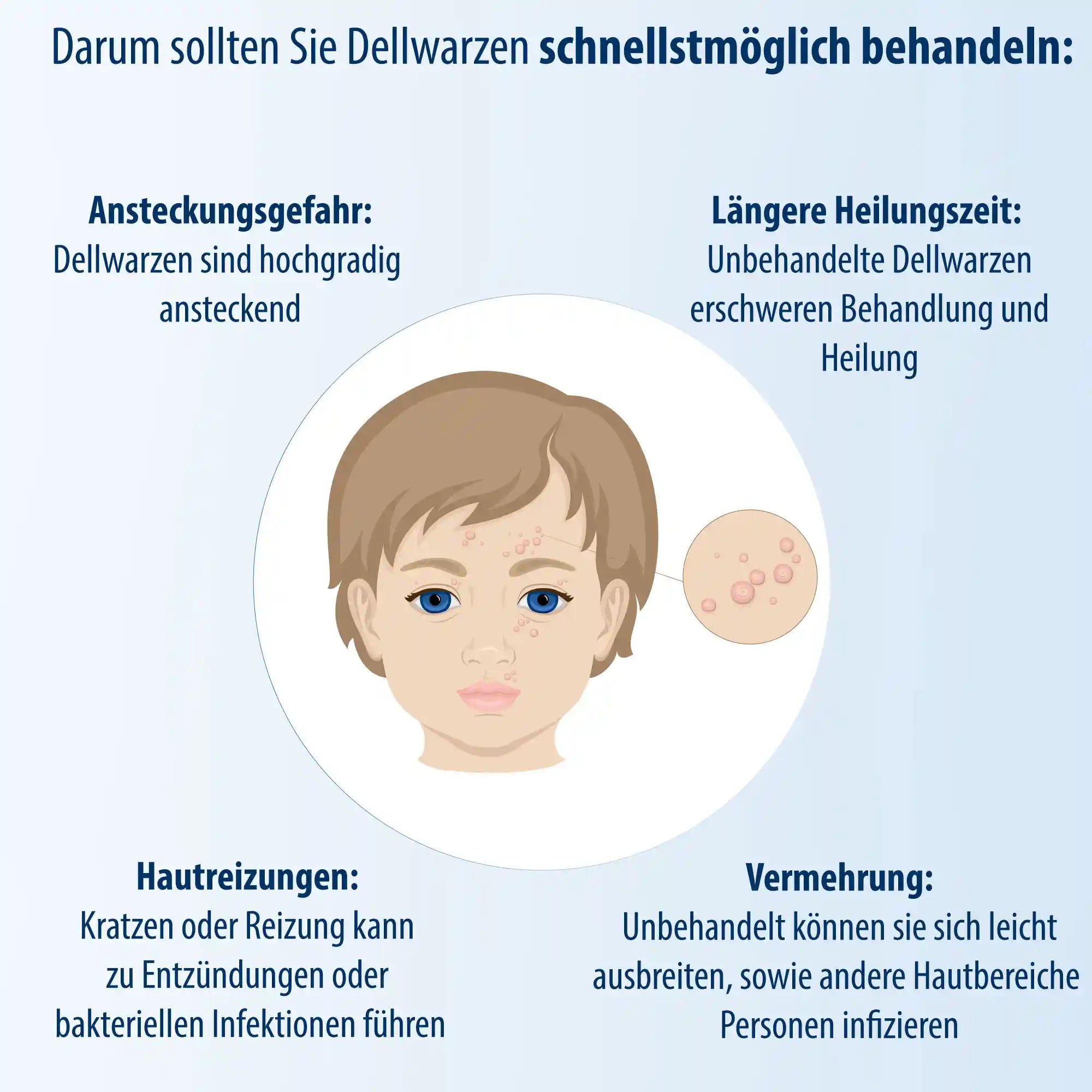 Dellwarzen Mittel