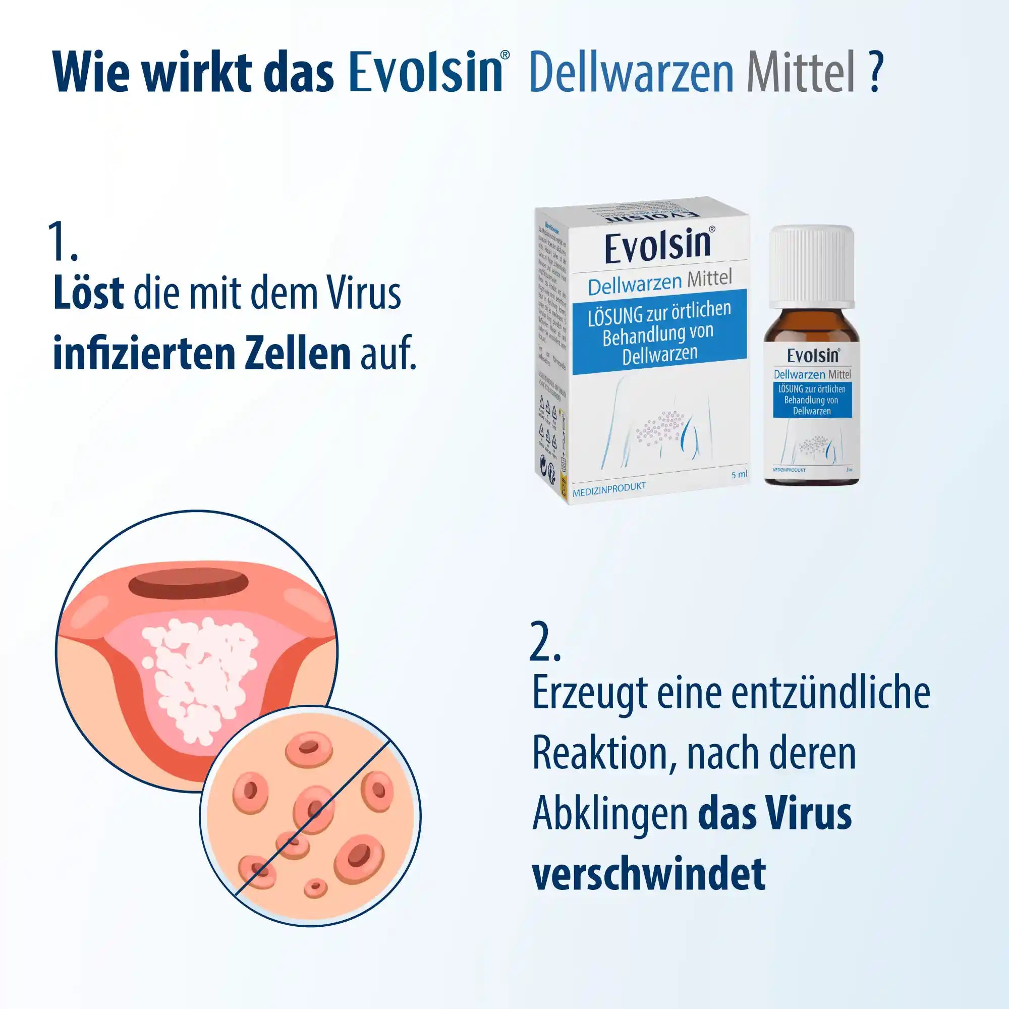 Dellwarzen Mittel