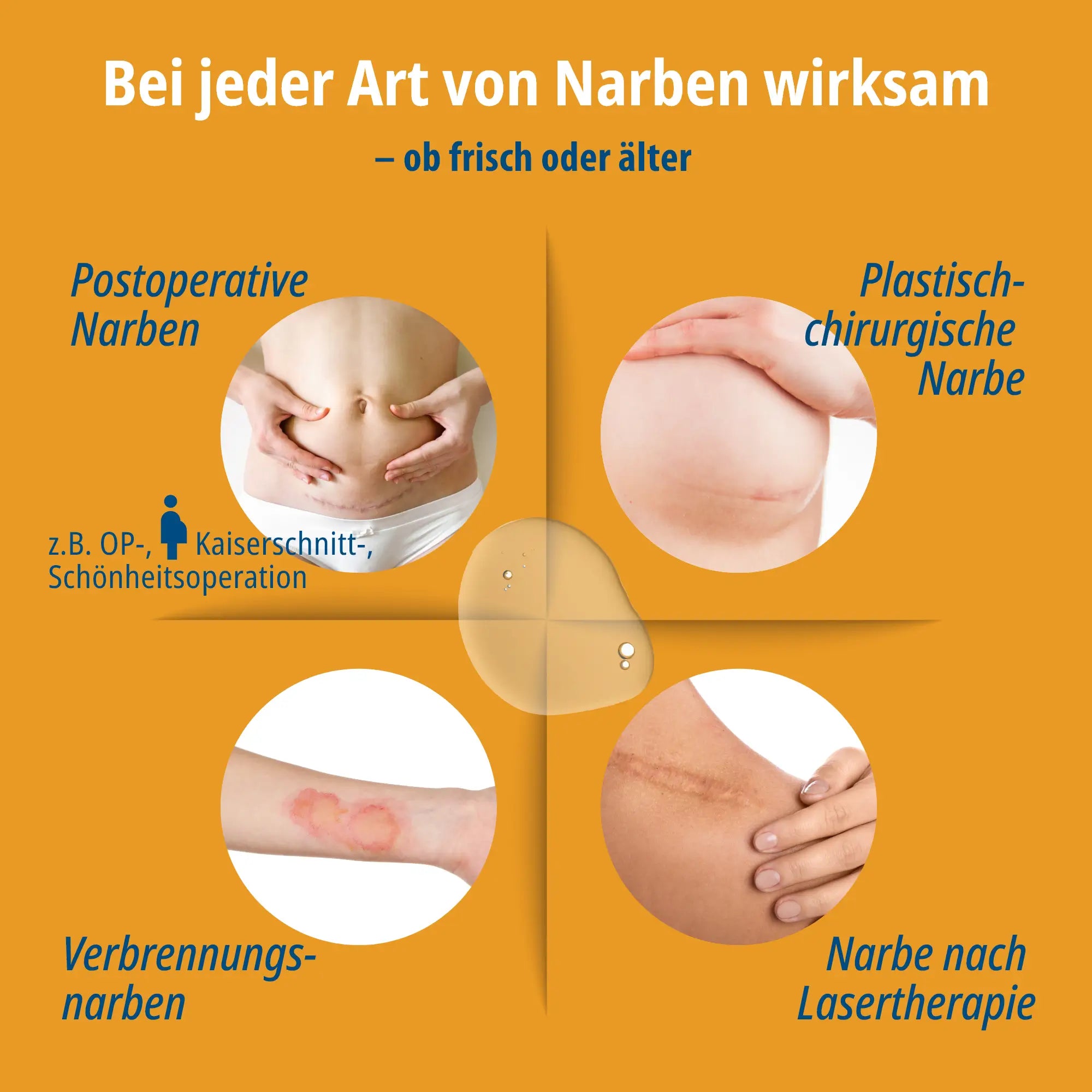 Evolsin Narben-Gel 20g für Kinder & Erwachsene