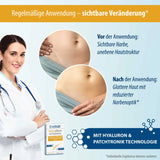 Narbenpflaster mit Hyaluron - 2 Stück
