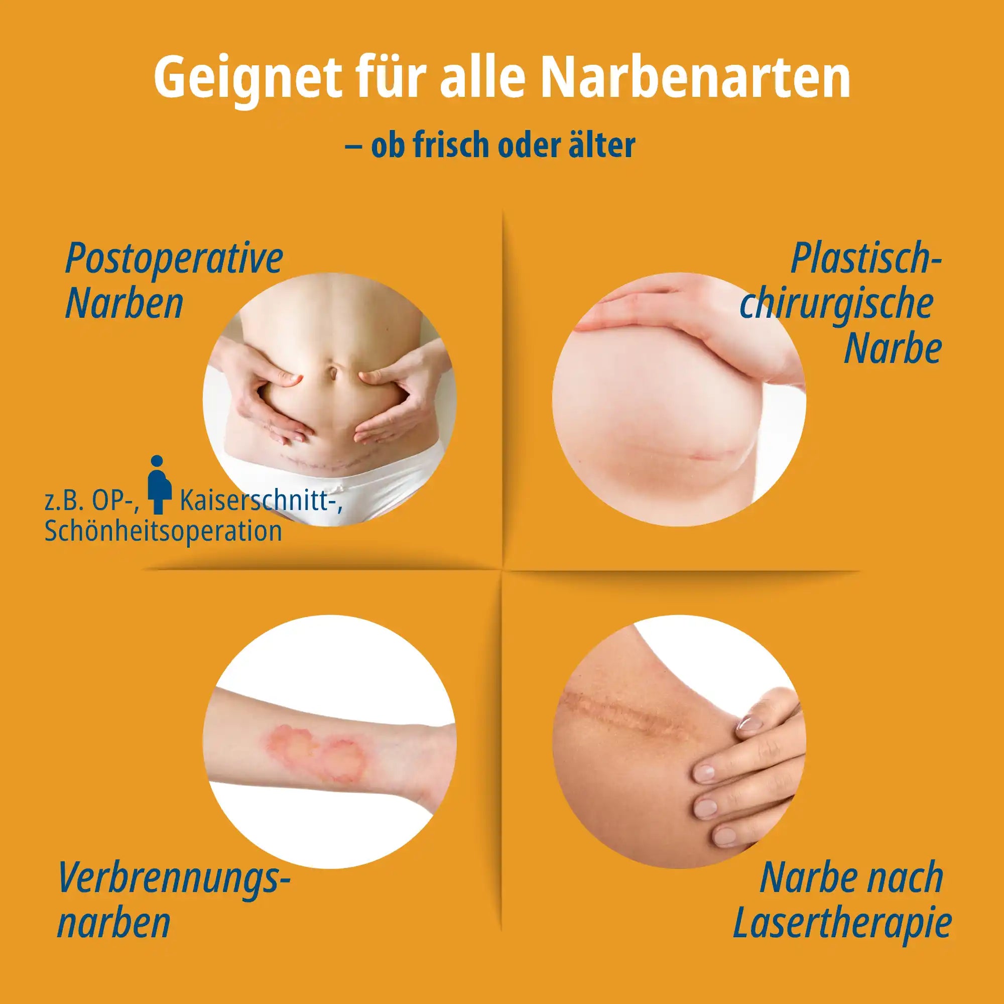 Narbenpflaster Doppelpack