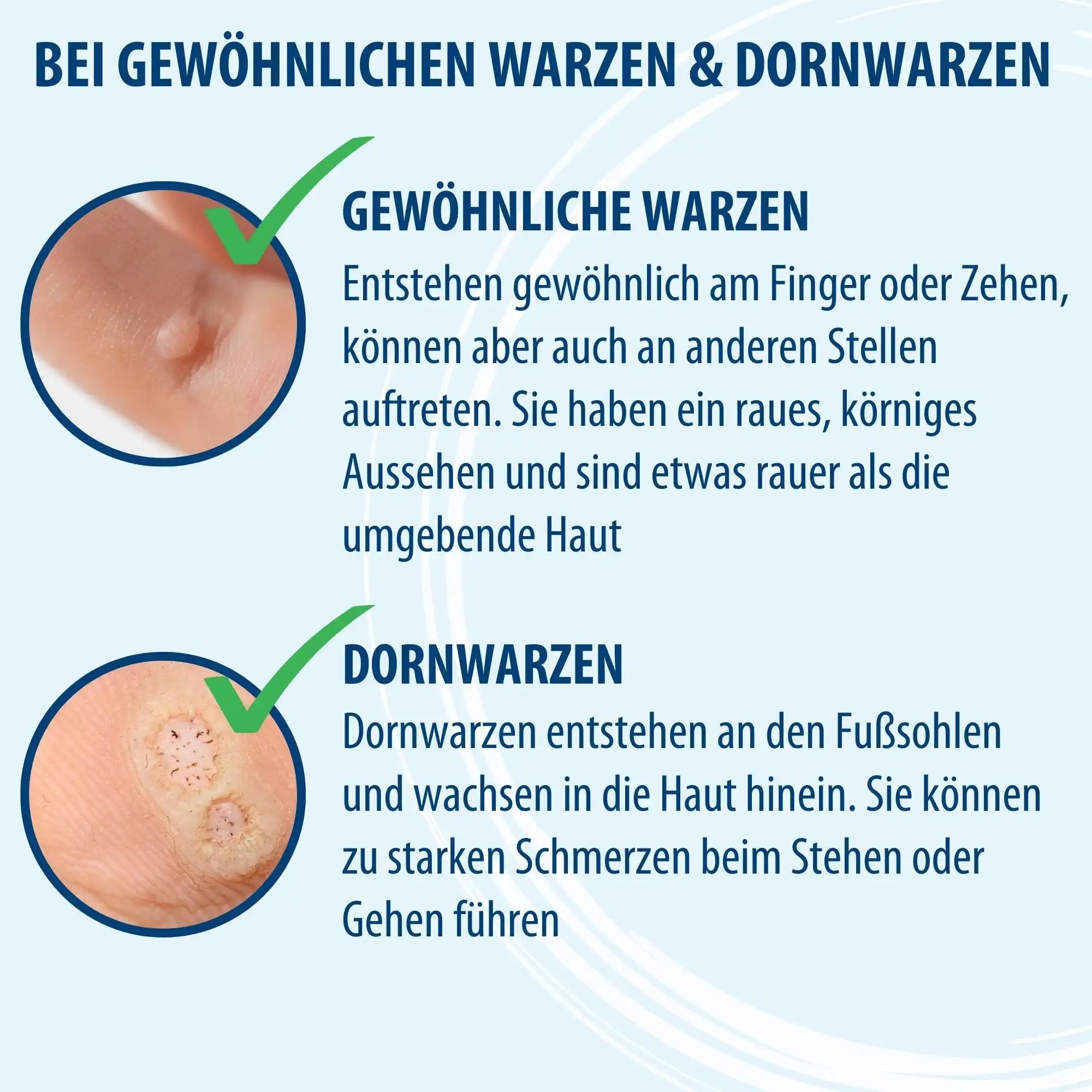 Warzenstift